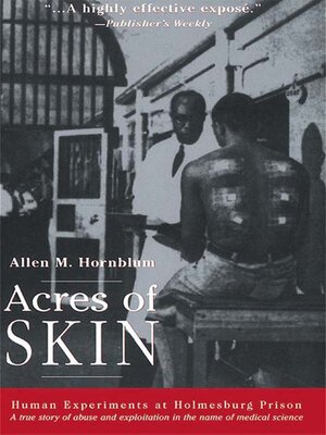 cover image of Acres of Skin